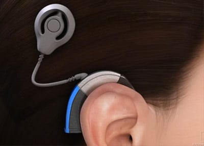 icon-cochlear